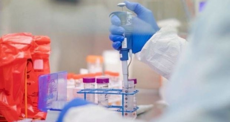 Dünyada koronavirusa yoluxanların sayı 21 milyonu keçdi