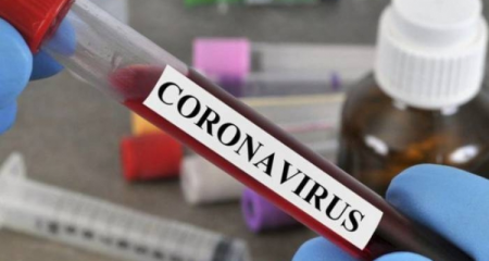Azərbaycanda ümumilikdə 836 908 koronavirus testi aparılıb
