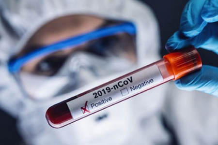 Azərbaycan Rusiyadan koronavirus dərmanı ala bilər