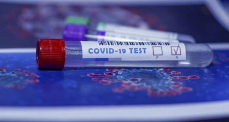 Moskva sakinlərinin koronavirus əleyhinə peyvənd edilməsinə başlanılıb