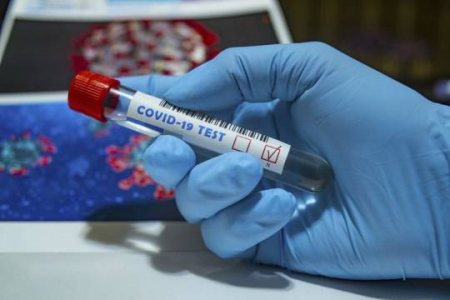 Azərbaycanda indiyədək 1095543 koronavirus testi aparılıb