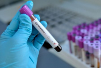 Azərbaycanda kənd karantinə alınıb, məktəblərdə koronovirus yoxlamaları aparılır