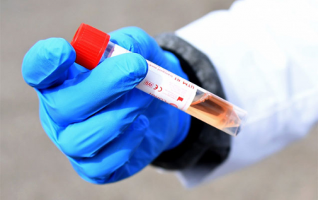 Azərbaycanda koronavirus sayında yeni rekord - Günün statistikası