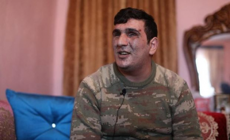 Vətən müharibəsində iki gözünü itirən qazimiz: “Mənə kömək göstərilsin, ailəmin üzünə baxa bilim”