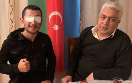 Hər iki gözünü itirən qazinin atası vəfat etdi - FOTO