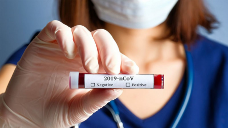 Azərbaycanda 29 yaşlı xanım məmur koronavirusdan öldü