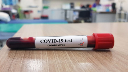 Daha 2 300 nəfər koronavirusa yoluxdu - 27 nəfər öldü