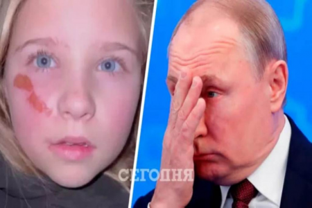 Ukrayna uşaqlarından Putinə MÜRACİƏT -VİDEO