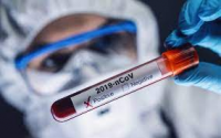 Azərbaycanda daha 6 603 nəfər koronavirusa yoluxub, 26 nəfər ölüb