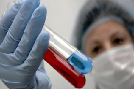 Azərbaycanda yeni virus yayıldı - İNFEKSİONİST AÇIQLADI