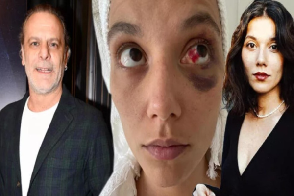 Sevgilisini döydüyü deyilən aktyor DANIŞDI: "Az qaldı..."
