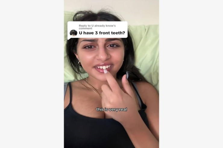 Blogerin dişləri sürətlə böyüməyə başladı
