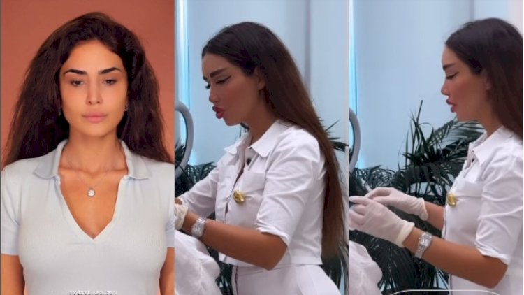 Pərvin Abıyeva yeni estetik prosedurdan sonra - Video