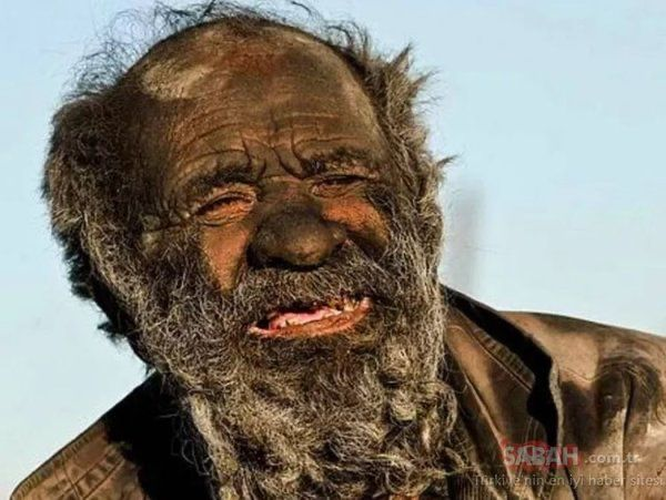 65 ildir yuyunmayan adam duş qəbul etdikdən sonra dünyasını dəyişib.