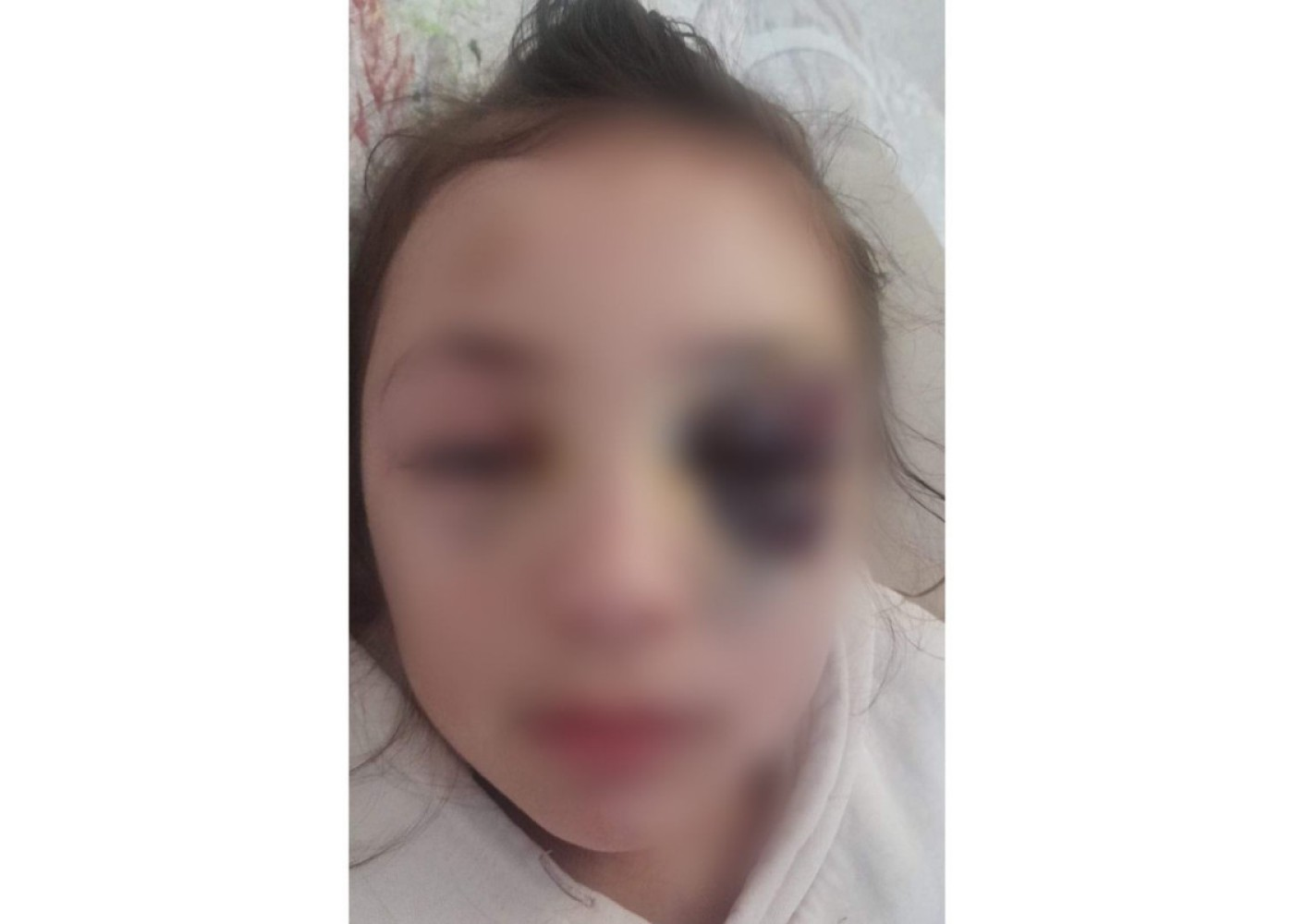 Prokurorluq məktəblinin xəsarət alması faktını araşdırır